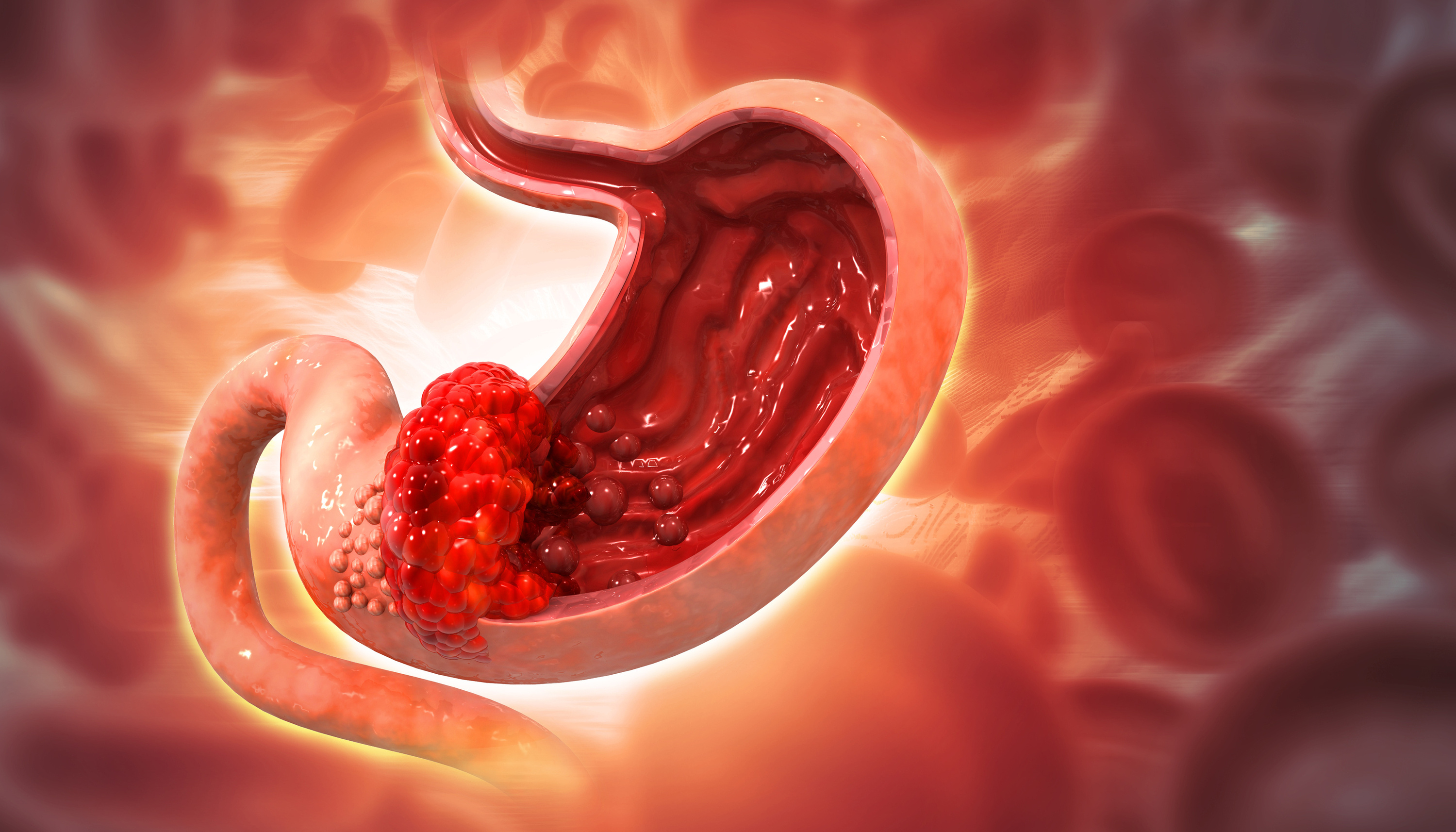 Une bactérie courante, le plus souvent inoffensive, vient d'être identifiée comme pouvant augmenter le risque de cancer de l'estomac. © Crystal light, Adobe Stock